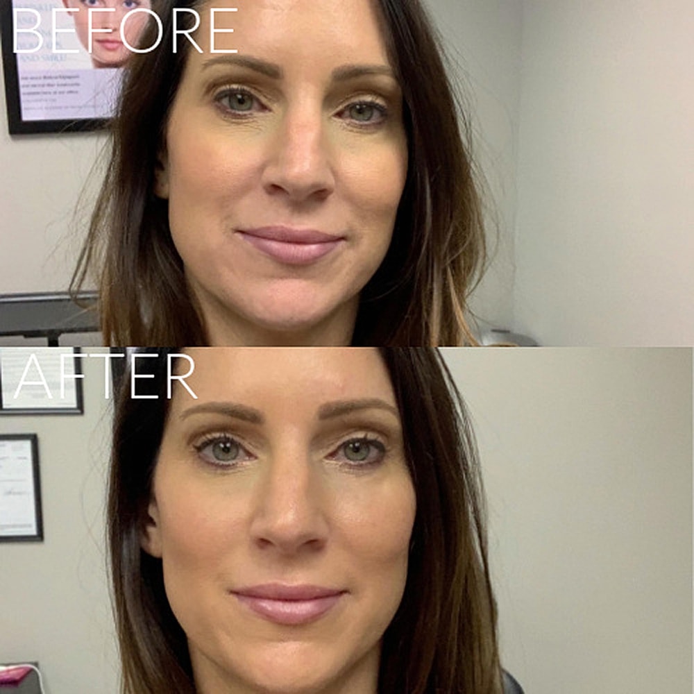 Before and after beauty treatment comparison.