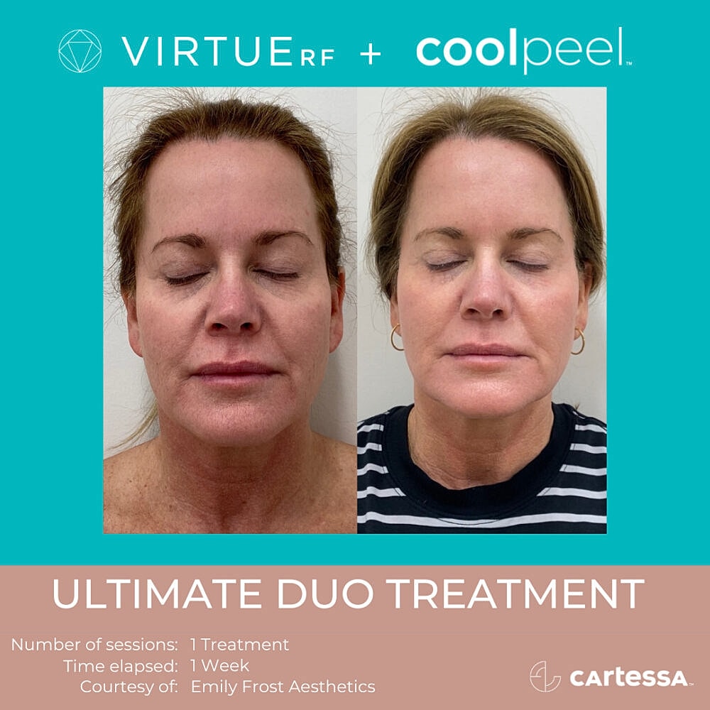 Before and after skin treatment results.
