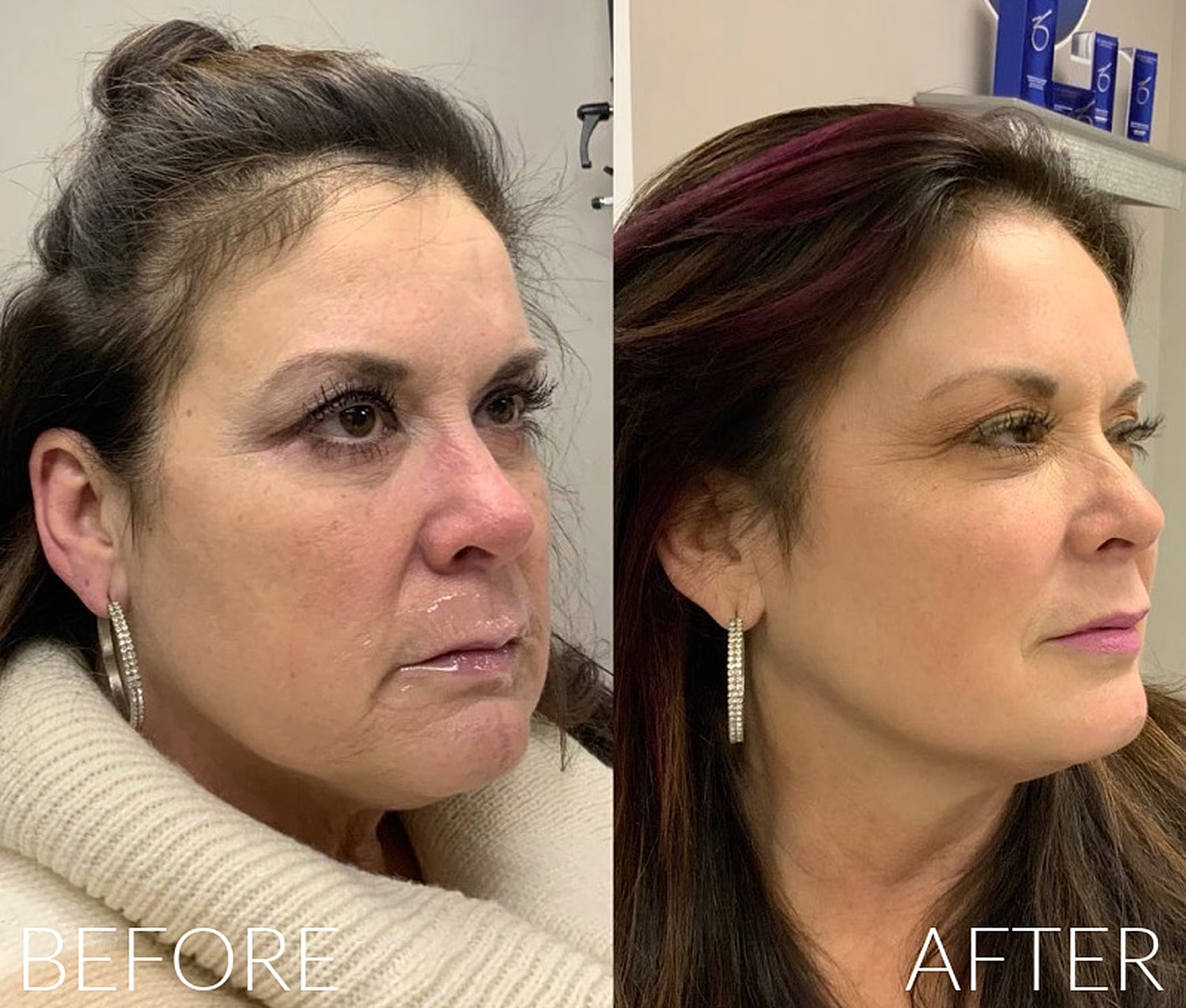 Before and after transformation of facial appearance.